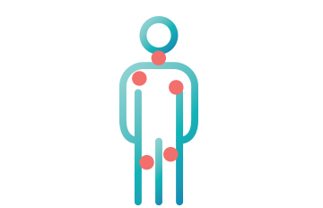 Body with B cells as red dots